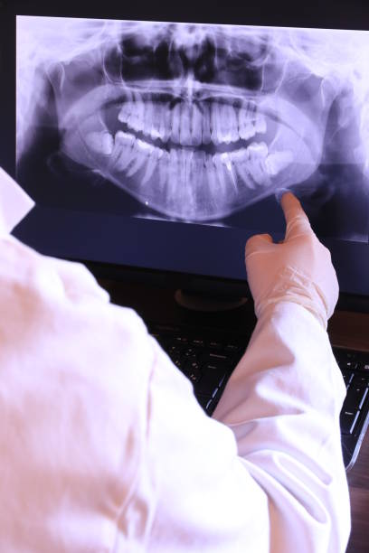 Best Broken or Chipped Tooth Repair in Cedar City, UT