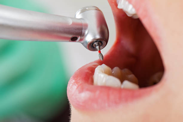 Best Walk-In Emergency Dental Services in Cedar City, UT